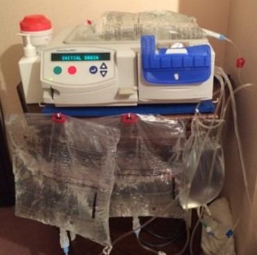 The peritoneal dialysis unit Jonathan used for almost a year to filter his blood. (Photo: Courtesy Monique Barbeau)