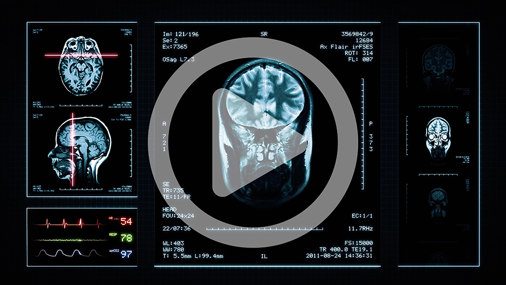 MRI-program